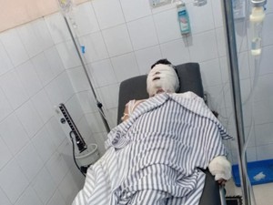 Alami Luka Parah, Korban Rampok-Bakar di Karawang Dirujuk ke RSHS Bandung