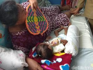 Alami Gizi Buruk Kronis, Tim Dokter Gelontor Asupan Gizi Balita Meilani Alfira