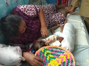 Meilani Alfira Balita Usia 2,8 Tahun Penderita Gizi Buruk Tubuhnya Sangat Kurus