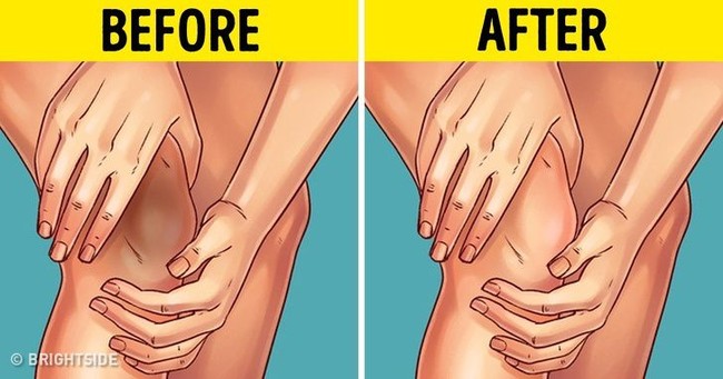 5 Scrub Alami dari Bahan Makanan untuk Mencerahkan Lutut dan Siku