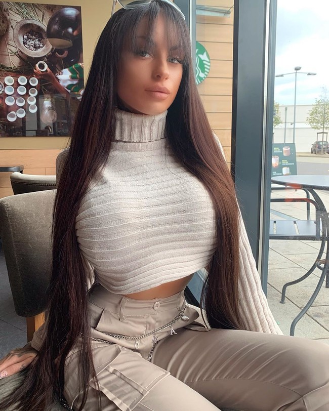  Hanya enam bulan setelah menjalani operasi pertamanya, wanita asal Dusseldorf, Jerman ini melakukan operasi kedua. Kemudian, tidak puas dengan hasilnya, Elisa kembali untuk operasi payudara ketiga pada 2014, yang dimaksudkan sebagai operasi terakhirnya. Foto: Instagram