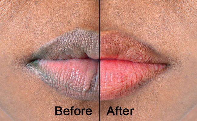 Scrub Alami dari 5 Makanan Ini Bisa Membuat Bibir Merah Natural