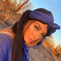 Memar setelah beberapa hari, tapi sangat mudah ditutup dengan lip gliss. Ini terlihat sangat alami, saya sangat senang dengan hasilnya, ungkap Leah usai menjalani filler bibir. Foto: dok. Instagram @leahmonroe_