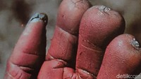 Wujud orang yang dikasihi sudah tiada. Namun kesedihan dan cinta masih tersisa dalam hati keluarga. Mewujudkan kesedihan yang dirasakan, seorang wanita dari keluarga terdekat haruslah memotong ruas jarinya. (Hari Suroto/Istimewa)