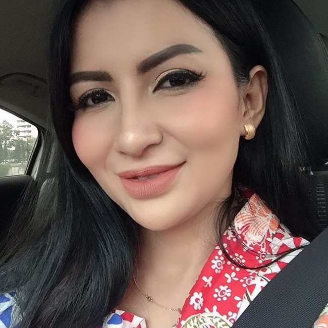Five Vi Rachmawati adalah salah satu aktris yang juga melakukan filler bibir. Saat awal-awal melakukan filler bibir, dirinya juga sempat mengaku bahwa bibirnya terlihat bengkak. Namun itu hanya berlangsung sementara karena sekarang dia sudah mendapatkan bentuk bibir yang diinginkan. Foto: Instagram@five_vrachmawati