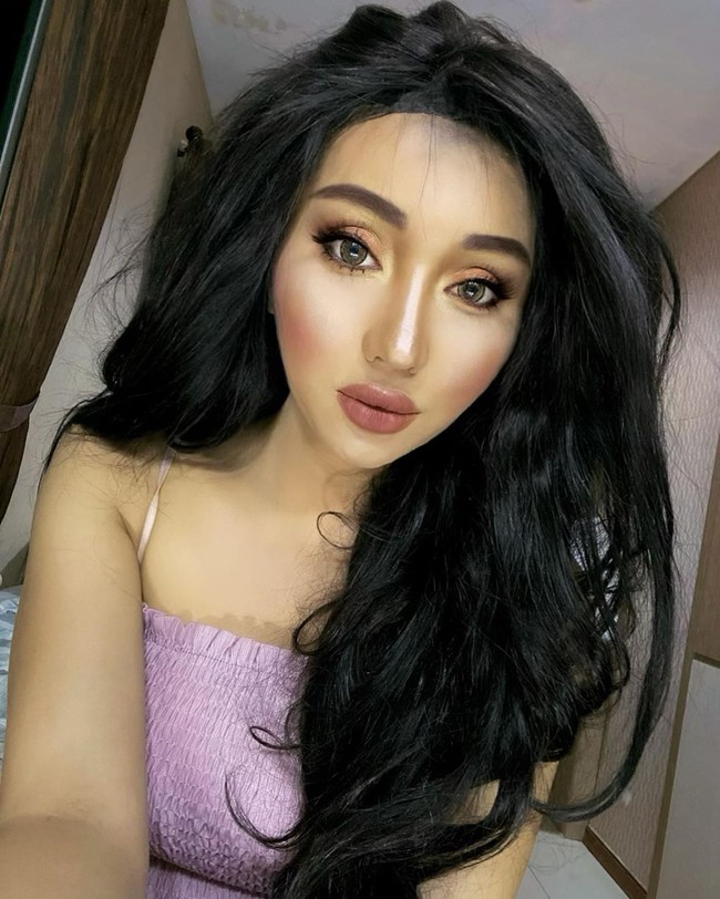 Lucinta Luna baru-baru ini menghebohkan publik karena unggahannya yang memperlihatkan penampakan bibir bengkak setelah melakukan filler bibir. Lucinta Luna mengaku melakukan filler bibir agar bisa terlihat seperti idolanya, Kylie Jenner. Foto: Instagram Lucinta Luna