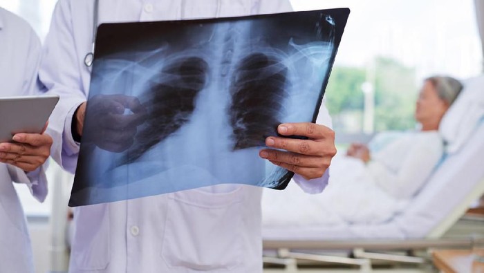Chest x-ray in hands of medical worker