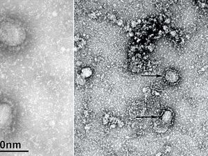 Jatim Hari Ini: soal Karakter Virus Corona dan Kasus Zikria Hina Risma
