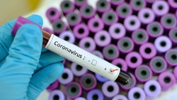 Ciri-Ciri Virus Corona, Pada Penderita Hingga Pencegahannya