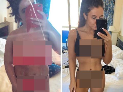 Sukses Diet, Wanita Ini Foto di Hotel dan Viral