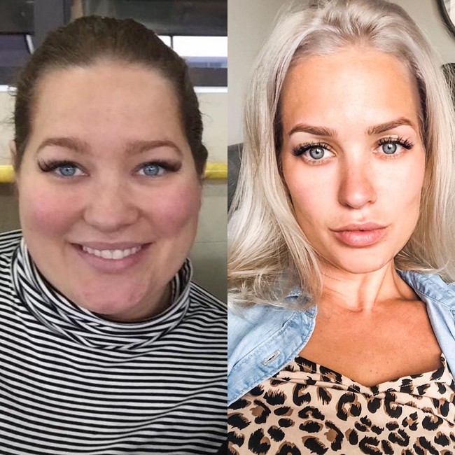 Meski menurunkan kebanyakan berat badannya dengan operasi bypass. Namun menurutnya, hal tersebut juga tak mudah. Itu keputusan paling menakutkan dan sulit yang pernah aku buat. Aku sekarang bisa menikmati hidup. Itu menakjubkan. Itu sulit dan benar-benar bukan pil sulap seperti yang orang bilang, tapi aku tidak menyesal, ungkapnya kepada Dailymail. Foto: Instagram @itsamommythang