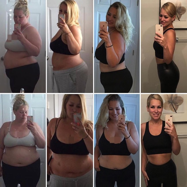 Itu menakutkan dan tidak nyata. Tubuhmu (berubah) dengan sangat cepat maka otakmu harus mengikuti. Itu tidak mengubah apa yang terjadi di dalam kepala, Itu hanya mengubah ukuran perut. Dismorfia sangat nyata untuk orang yang operasi ini, kata Kelsey yang sekarang berbobot 59 kg. Foto: Instagram @itsamommythang