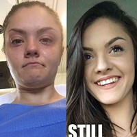 Pada usia 15 tahun, saya mencoba bunuh diri karena dibully, pelecehan verbal, dan pelecehan terus menerus dari siswa lain selama bertahun-tahun. Alih-alih mencari bantuan, saya menyimpan semuanya di dalam karena saya tidak merasa ada orang yang bisa membantu saya, cerita Aleen seperti dilansir Daily Star. Foto: Instagram