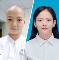 Lawan Virus Corona, Perawat di China Cukur Rambut hingga Botak