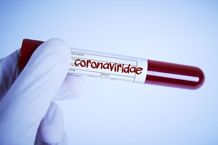Doctor Holding a Corona Blood sample in his hand