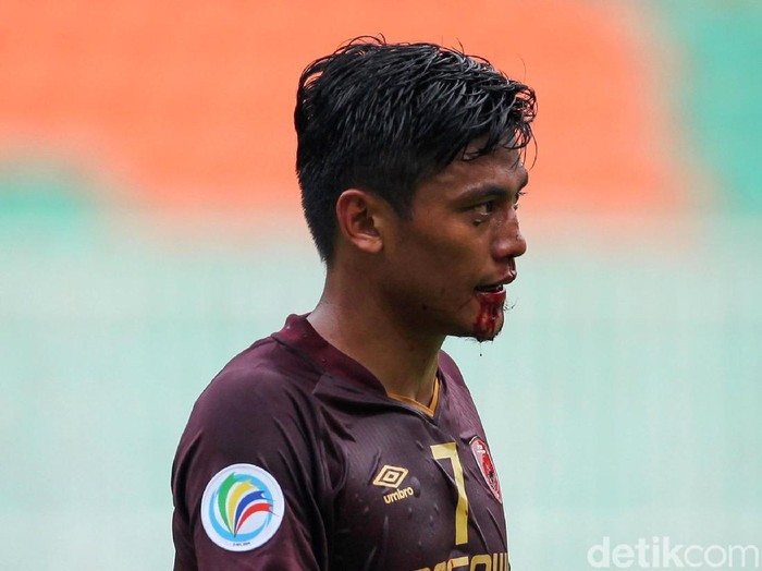 Usai mencetak gol, Irsyad Maulana terkapar setelah berbenturan dengan pemain Lalenok United. Hasilnya, Irsyad mengalami patah hidung dan dibawa ambulans.