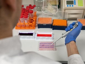 Peneliti Indonesia Bersiap Kembangkan Vaksin Virus Corona COVID-19