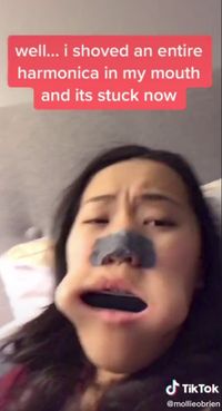 Harmonika Nyangkut di Mulut, User TikTok Ini Dilarikan ke RS