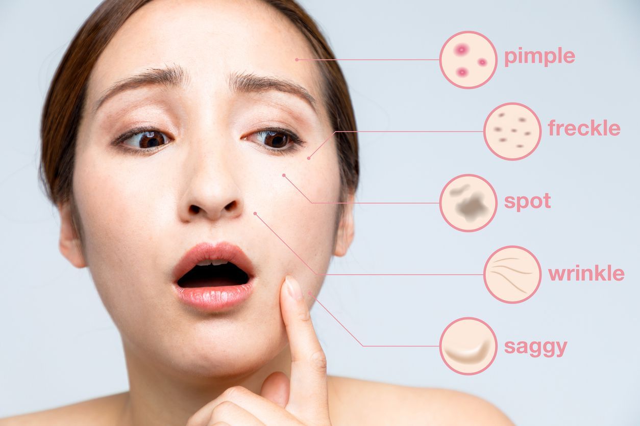 woman skin trouble. pimple, freckle, spot, wrinkle, saggy.