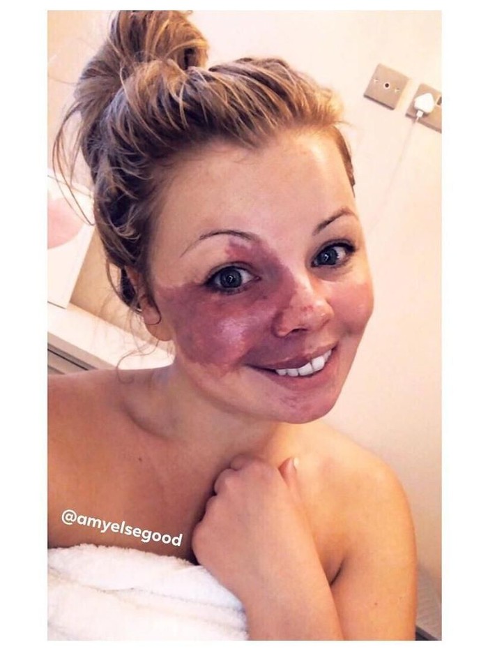 wanita punya tanda lahir di wajah