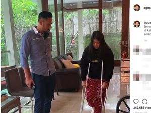 Putri AHY Patah Tulang, Ini Faktor yang Bisa Pengaruhi Waktu Pemulihan
