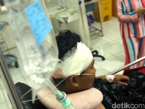 Polisi Masih Buru Gerombolan Bermotor yang Aniaya Anak Petinggi PP