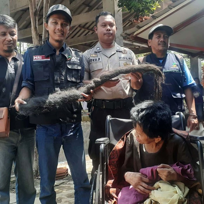 Rambut Gimbal Sukiyah yang Jadi Sarang Tikus Nggak Jadi Dikubur Potongan rambut gimbal Sukiyah (50) yang sempat jadi sarang tikus dan kecoak batal dikubur. Rambut gimbal itu rencananya bakal disimpan setelah dibersihkan.