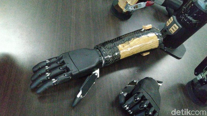 Tangan Bionik Buatan Undip