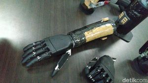 Tangan Bionik Canggih Buatan Undip Semarang