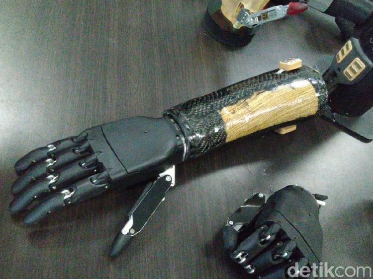 Tangan Bionik Canggih Buatan Undip Semarang