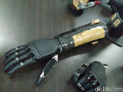 Tangan Bionik Canggih Buatan Undip Semarang