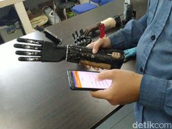 Tangan Bionik Canggih Buatan Undip Semarang