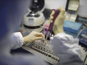 5 Bulan Berlalu, Ini yang Ilmuwan Ketahui soal Virus Corona