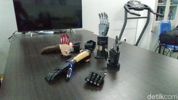 Mereka sudah punya 4 jenis produk tangan bionik. Ada Asta Bionic Hand, Bimo Bionic Hand, Albiondi Bionic Hand dan Bionic Hand 2020 (Angling Adhitya Purbaya/detikcom)