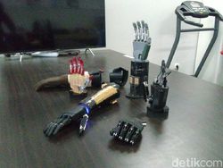 Tangan Bionik Canggih Buatan Undip Semarang