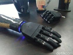 Tangan Bionik Canggih Buatan Undip Semarang