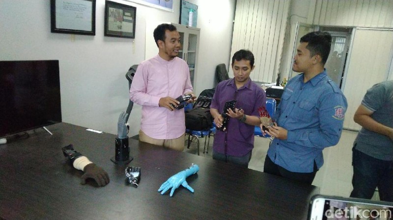 Tangan Bionik Buatan Undip