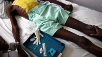 Obat-obatan modern memang mampu membuat penderitanya hidup selama bertahun-tahun. Namun penyakit ini berakibat fatal di negara berkembang atau miskin, di mana 95% infeksi HIV terjadi. Shaul Schwarz/Getty Images.