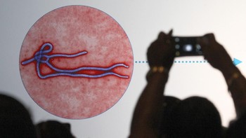 Virus ebola memiliki bentuk yang mirip cacing ya, detikers. Foto: Getty Images