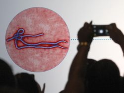 Cantik Tapi Berbahaya, Potret Virus di Bawah Lensa Mikroskop