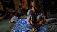 Virus HIV yang dapat menimbulkan penyakit AIDS juga menjadi momok menakutkan bagi masyarakat dunia hingga kini. Virus ini diketahui pertama kali muncul di awal tahun 1880-an. Paula Bronstein/Getty Images.