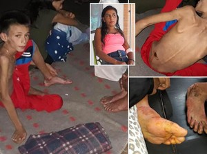 Tersesat 34 Hari di Hutan, Ibu dan Anak Ini Bertahan Hidup Makan Buah Liar