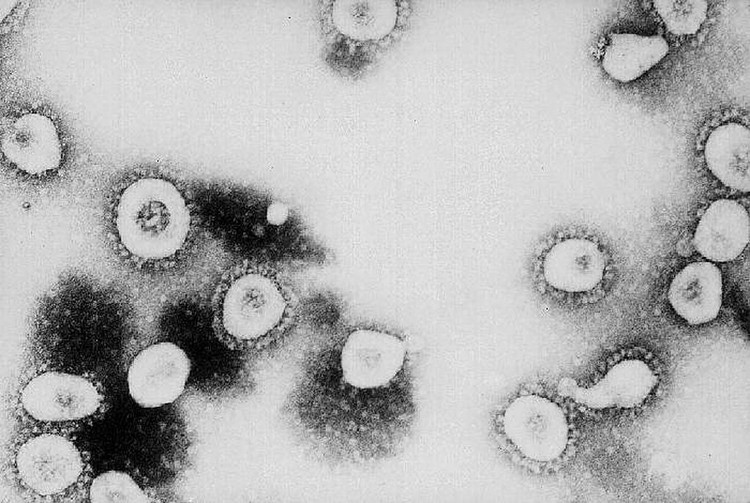 foto mikroskopik virus corona