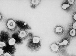 Wujud Virus Corona Dilihat dari Dekat, Mengerikan!