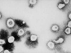 Kata Kemenkes Soal Kemungkinan Virus Corona Masuk Indonesia Tapi Tak Terdeteksi