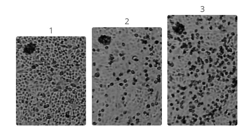 foto mikroskopik virus corona