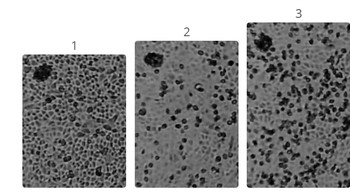 Para peneliti di Peter Doherty Institute for Infection and Immunity di Melbourne, Australia mengembangkan virus corona baru dari sampel pasien. Foto: YouTube/Doherty Institute. Montage by ITGD Design Team/Vikas Vashisht.  