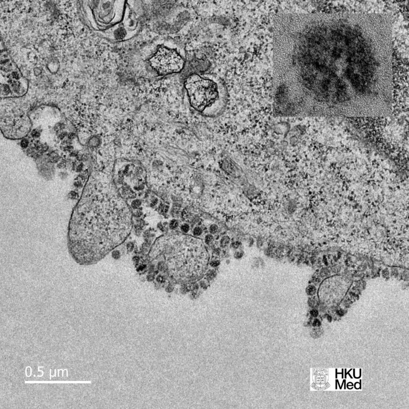 foto mikroskopik virus corona