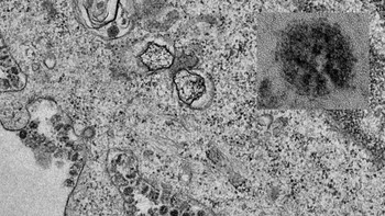 Mikrograf elektron bagian tipis dari virus corona yang tumbuh di dalam sel. Foto: John Nicholls, Leo Poon dan Malik Peiris, University of Hong Kong (Twitter/@hkumed).