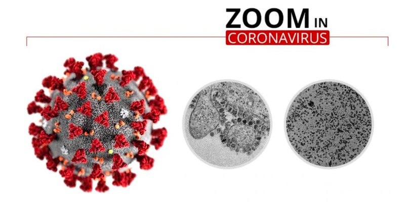 foto mikroskopik virus corona